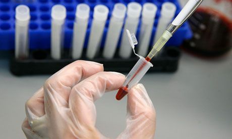 Od 40 testiranih jedna osoba HIV pozitivna