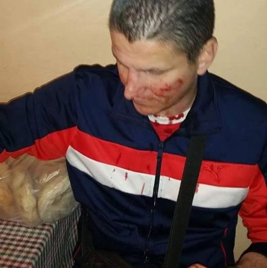 Navijači iz Vranja povređeni u Skoplju