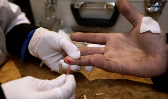 BESPLATNO i ANONIMNO testiranje na HIV u centru Leskovca