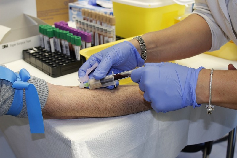 Oko 200 južnjaka se prijavilo da donira krvnu plazmu