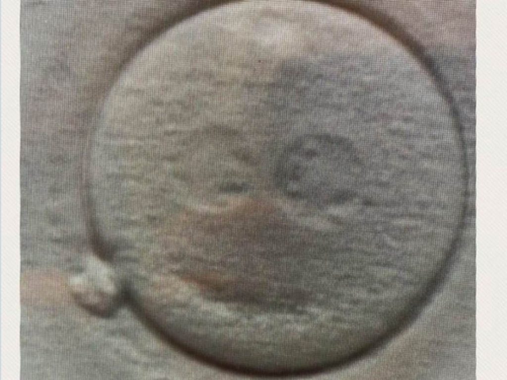Nasmejani embrion iz laboratorije doktora Stojkovića