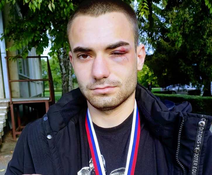 Srebro za Stefana Filipovića iz Leskovca na Seniorskom prvenstvu Srbije u boksu