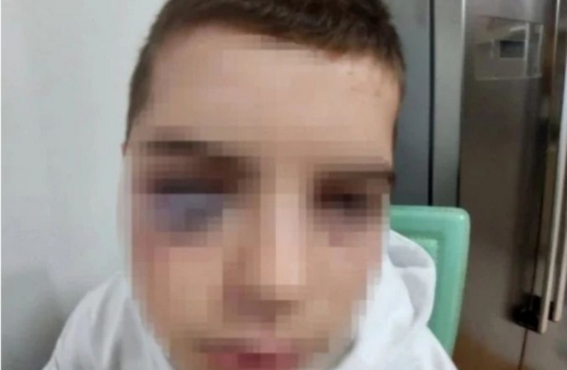 Tinejdžera iz Surdulice napao vršnjak nakon treninga