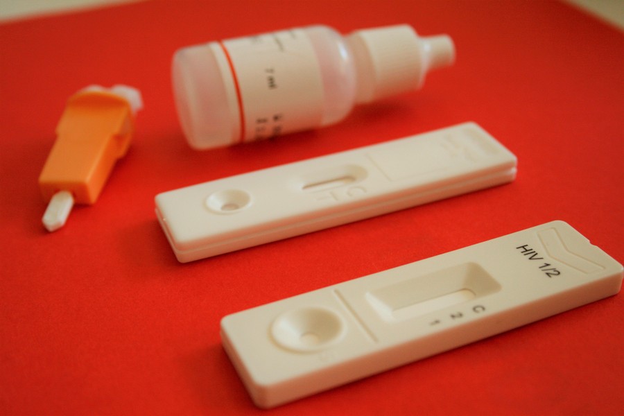 Besplatno testiranje na HIV danas u prostorijama Potent-a u Nišu