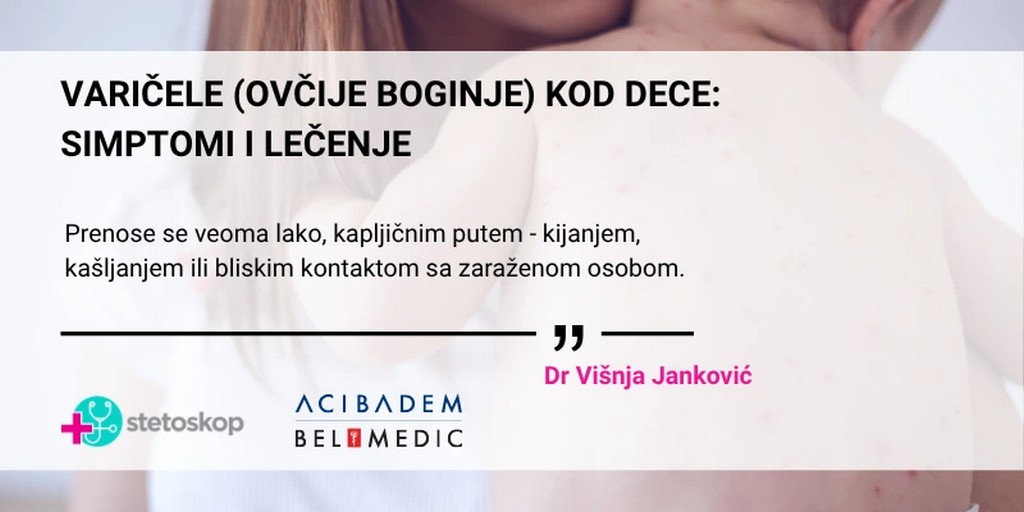 VARIČELE (OVČIJE BOGINJE) KOD DECE: SIMPTOMI I LEČENJE